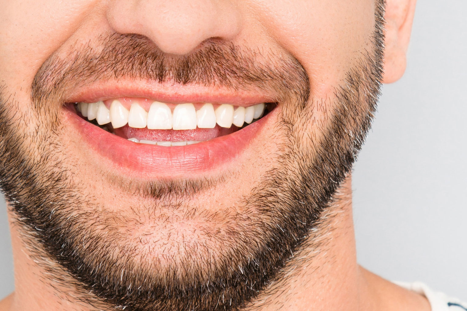 Porcelain Veneers Detail Dental